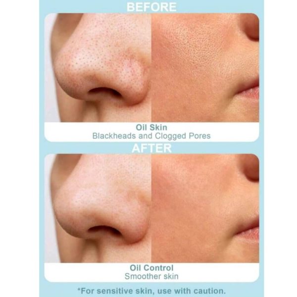 Deep Cleansing Mask Charcoal Bubbling